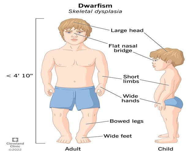 dwarfism 