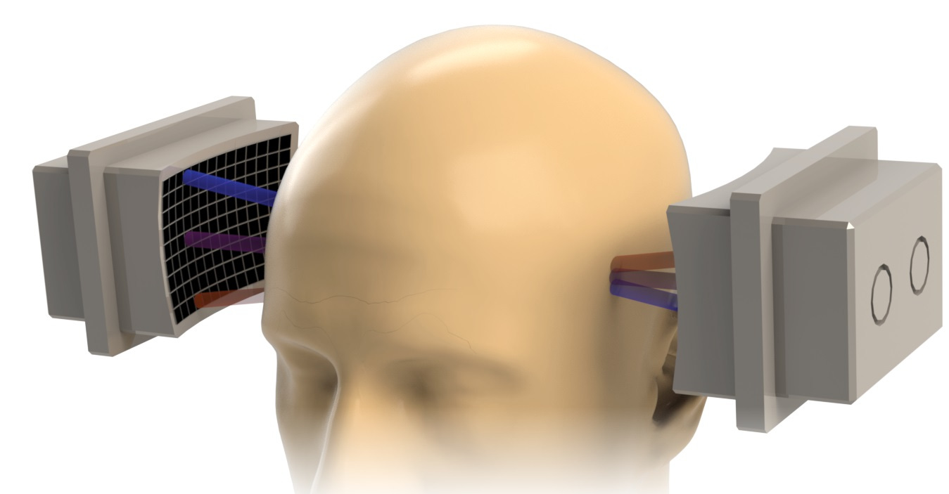 SPIRE Deploys Effective, Safe Ultrasonic Neuromodulation Device - Focused  Ultrasound Foundation