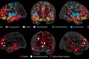 Electrodes at multiple brain regions reveal brain activity in real time. Colored dots show the locations of all of the electrodes across all patients, color-coded by brain region. Red dots in the lower images show the locations of the electrodes in the DMN.