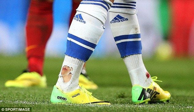 Eden Hazard's Achilles after 20 mins vs Slavia Prague (fouled twice by  Kudela) : r/soccer