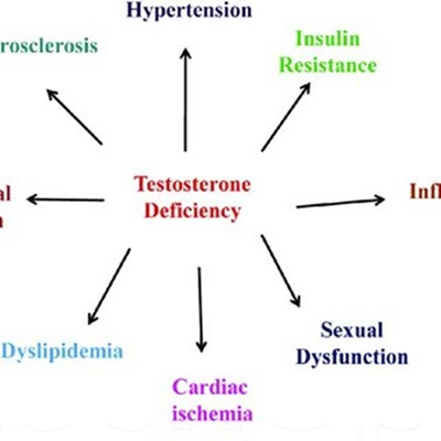 testosterone deficiency 