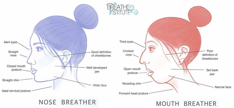 Mouth Breathing In Children & Adults | Restoring nasal breathing | Tongue