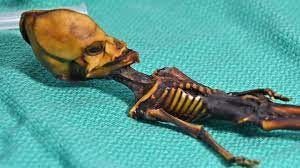 DNA Proves 'Alien' Was Actually Human Girl—Who Was She? - The Atlantic