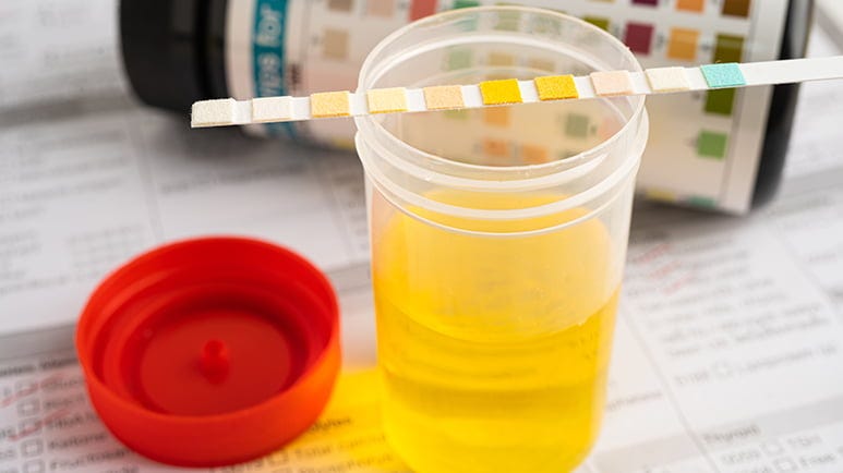 what urine odor says about your health