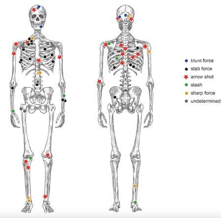 Localisation des blessures sur les squelettes de Tollense