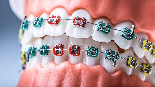 Orthodontics Office | Oral Design Dental | Tooth Alignment Dentistry Utah