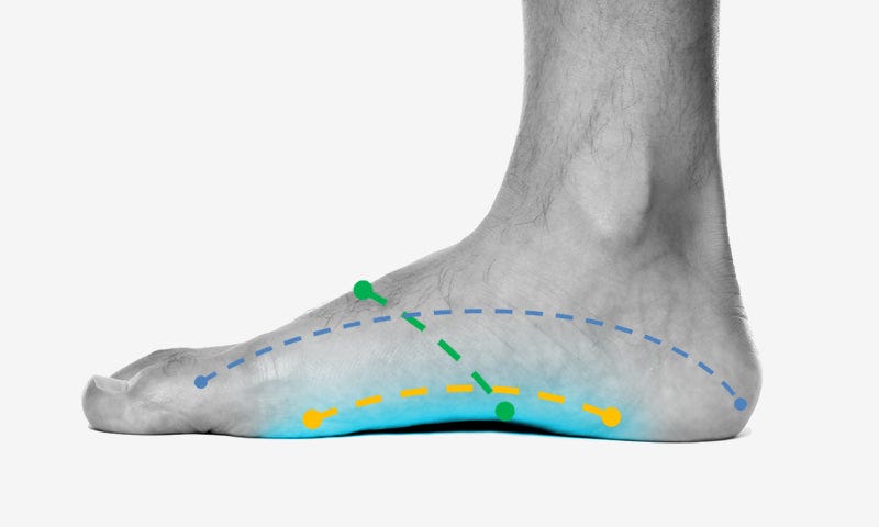 7 Most Likely Causes of Pain in the Foot Arch | Symptoms & Treatments —  Feet&Feet