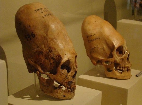 How to explain the elongated skull which dates back more than 3,000 years  old or more - Quora