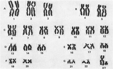 Ordered arrangement of paired chromosomes 1-22, plus X and Y chromosomes.