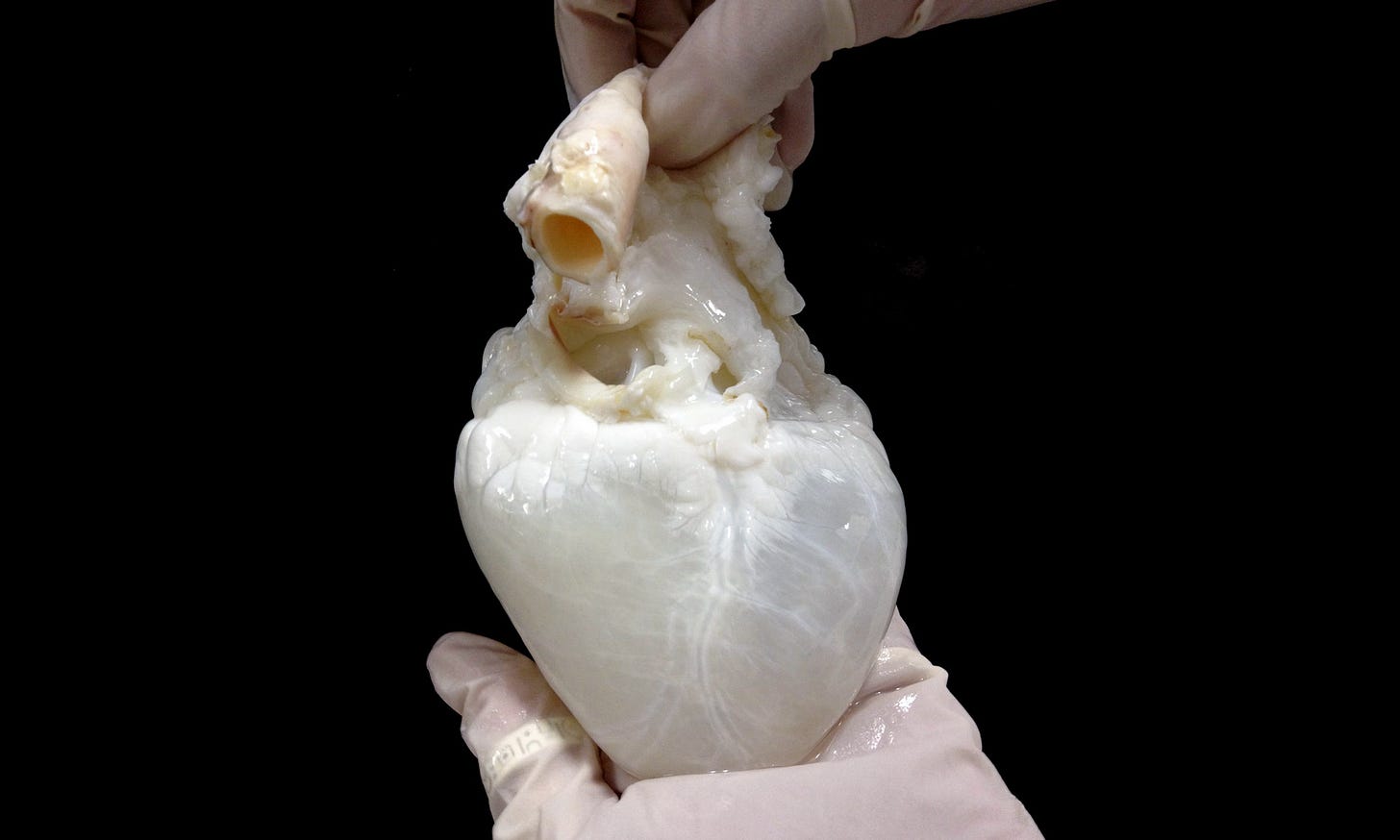 A ghost heart? |