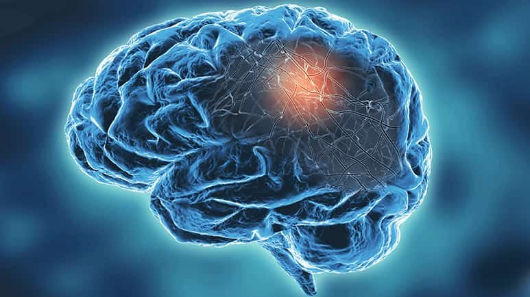 probiotics alzheimers neurodegenerative diseases