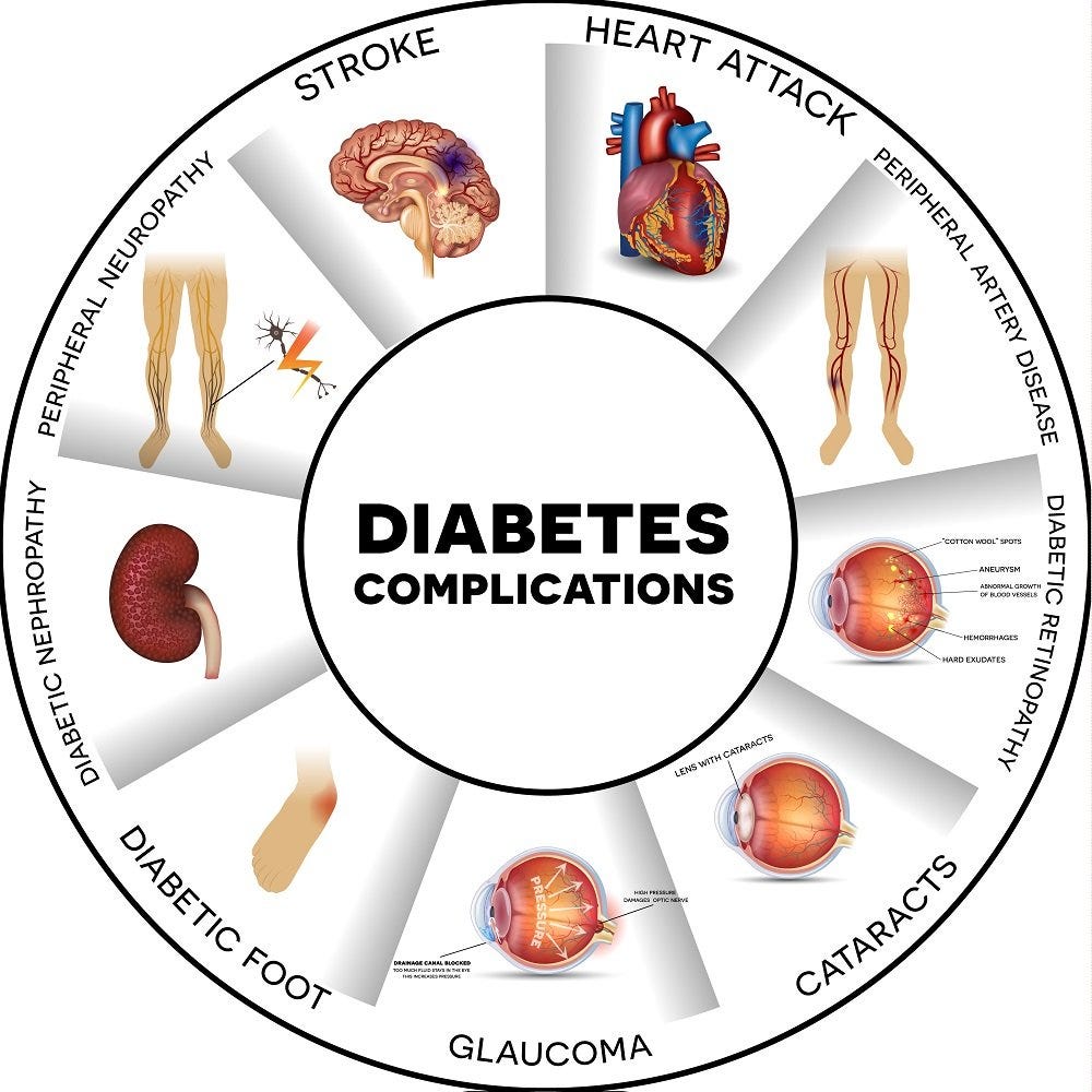 Diabetes and Vascular Disease — Vascular Cures