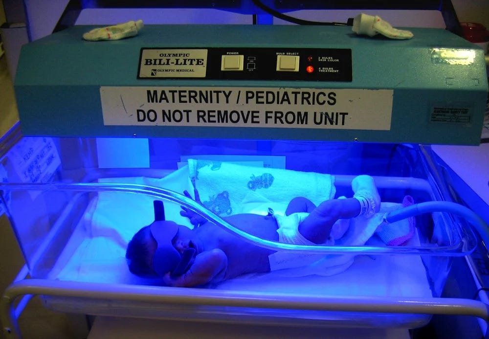 picture of baby under bilirubin light phototherapy