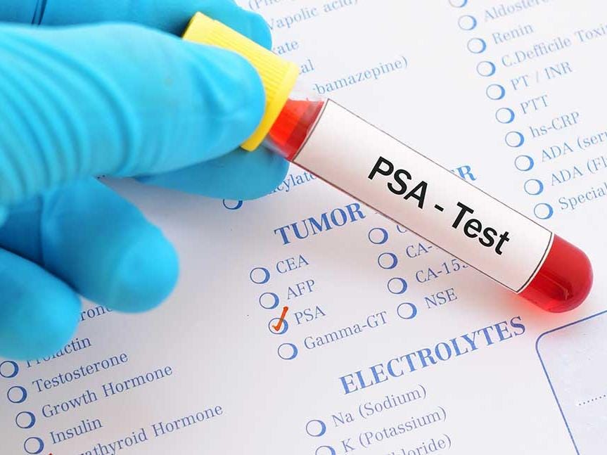 Prostate-Specific Antigen (PSA) Test - NCI