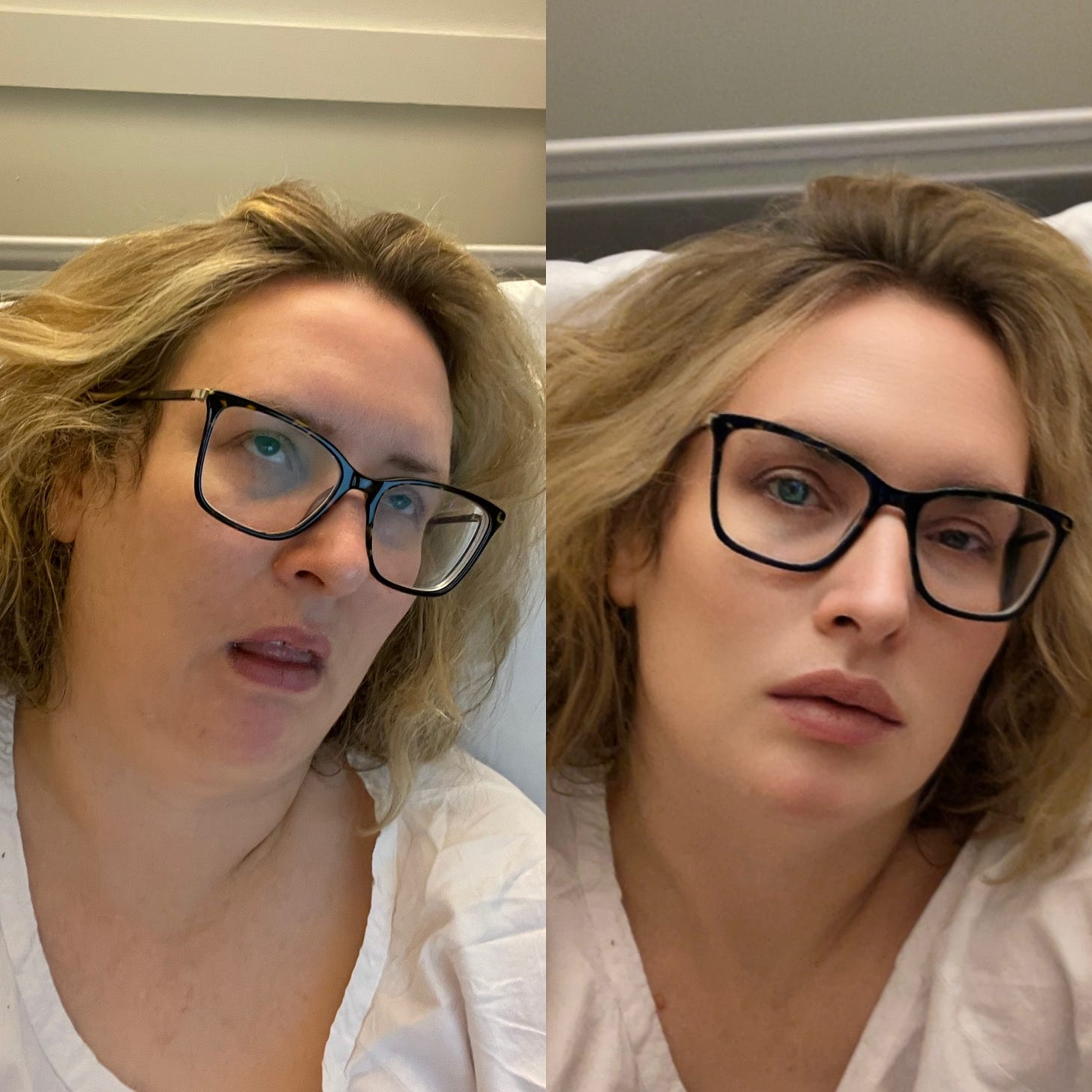 Two photos of Eleanor side by side - on the left, she looks dishevelled and has her mouth gaping and eyes rolling back; on the right, the photo has been filtered to make her look like she has full make up on and perfect skin