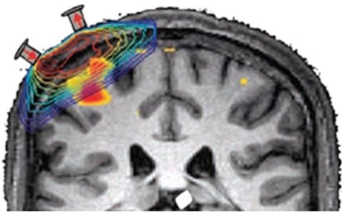Near Infrared Spectroscopy (NIRS) Brain Imaging Laboratory | Biomedical  Research Imaging Resources | University of Pittsburgh