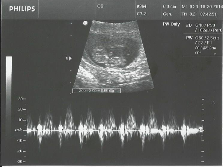 Ultrasound 20Oct2014