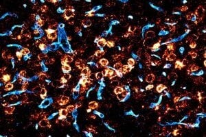 Credit: Deverman lab Brain vasculature (in blue) surrounded by RNA (in orange) transcribed from the gene delivered to the brain in humanized mice using an engineered AAV targeting the human transferrin receptor.