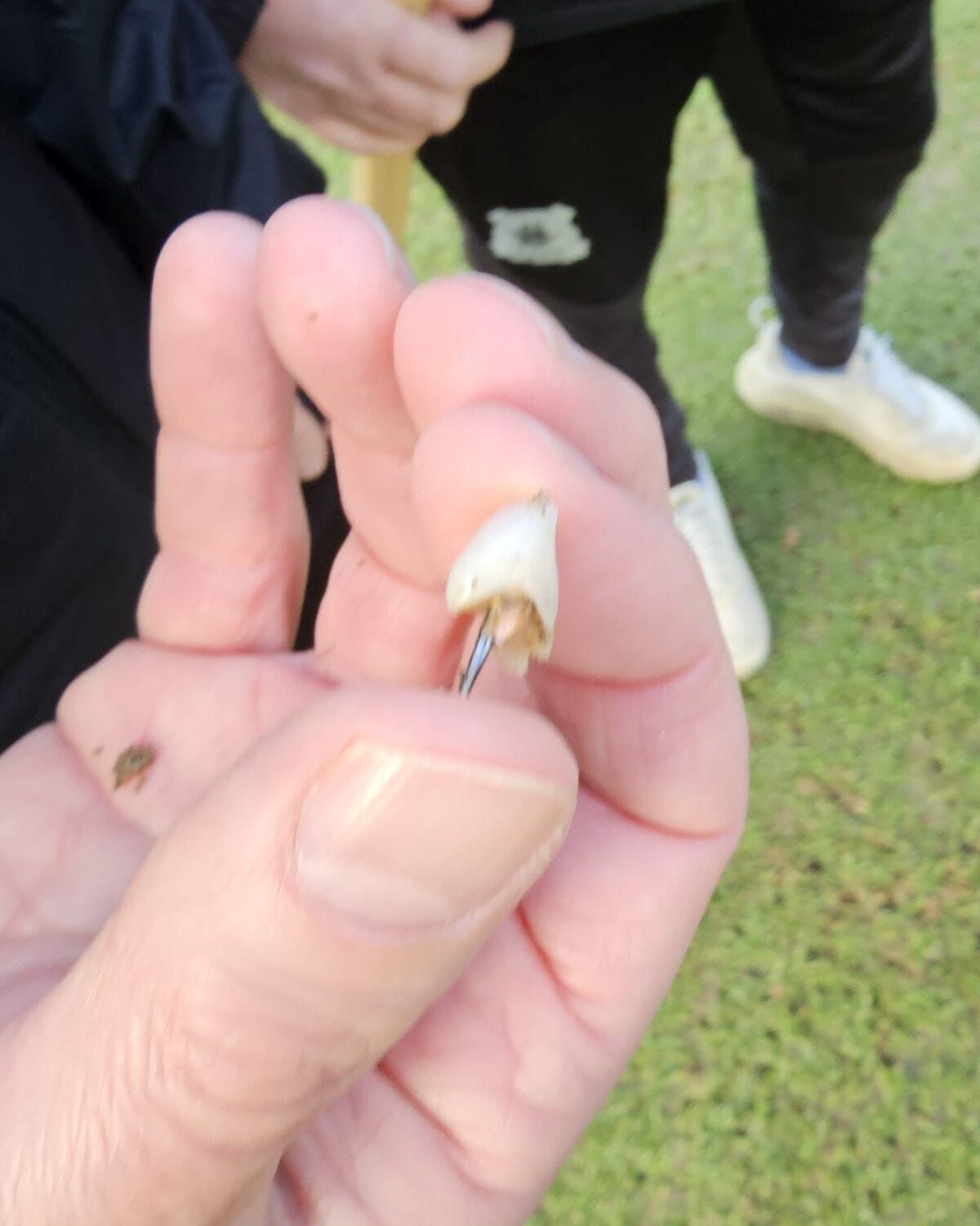 Nikola Katic's tooth that fell out during Argyle's win over Liverpool.