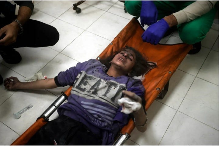 A Palestinian girl wounded in bombardment receives treatment at Nasser Hospital. 