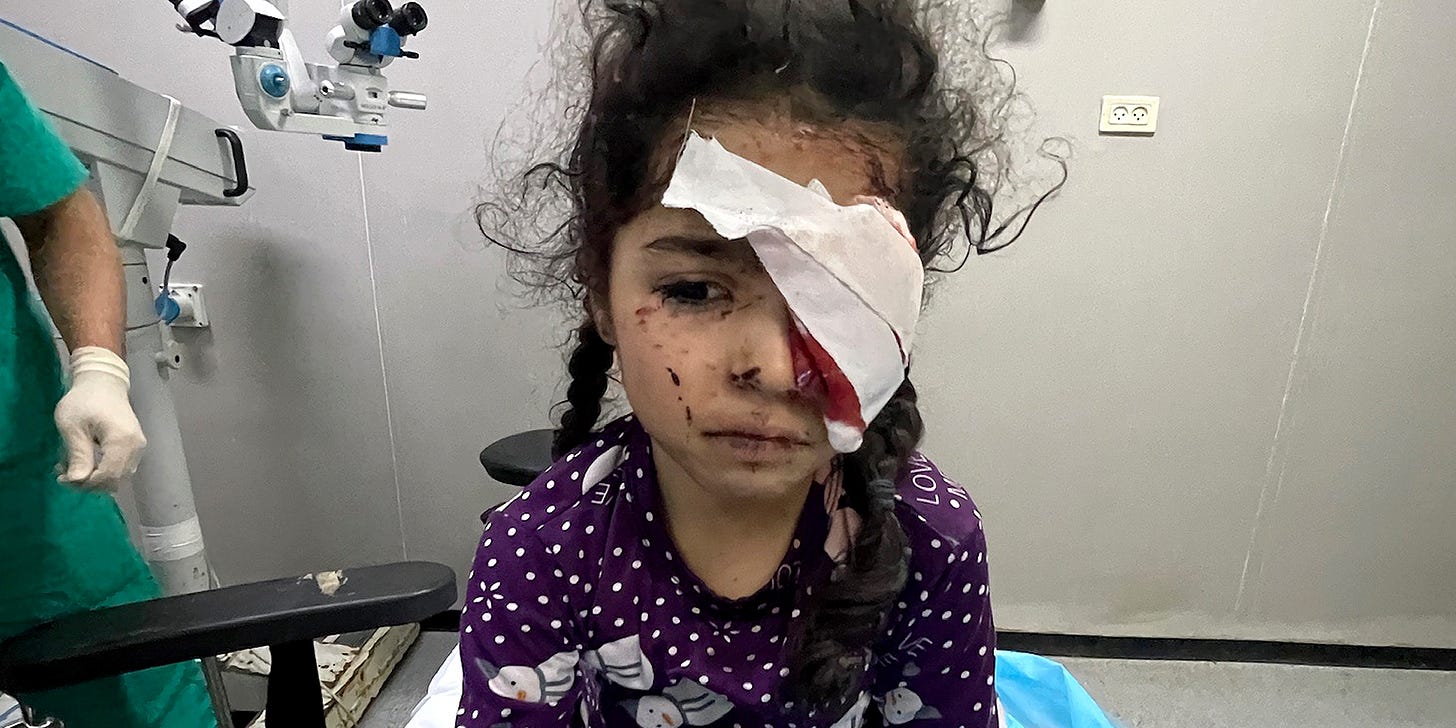 A 6-year-old Palestinian girl after an eye removal operation at European Hospital near Khan Younis, Gaza. Shrapnel and a 2- to 3-inch stone hit her left eye after the bombing of a building next to the makeshift shelter she was living in with her family. According to Dr. Yasser Khan, her father died and her mother was injured in an Israeli attack.