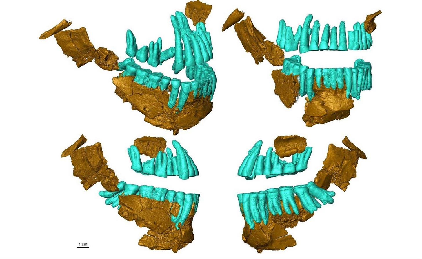 Four panels showing a reconstructed jawbone with teeth and maxillary teeth arranged in a dental arch, from four viewpoints Four panels showing a reconstructed jawbone with teeth and maxillary teeth arranged in a dental arch, from four viewpoints