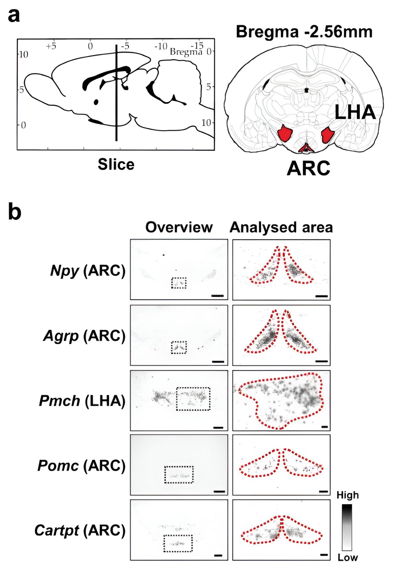 Jet lag disorder associated with shift work can lead to brain changes increasing appetite 