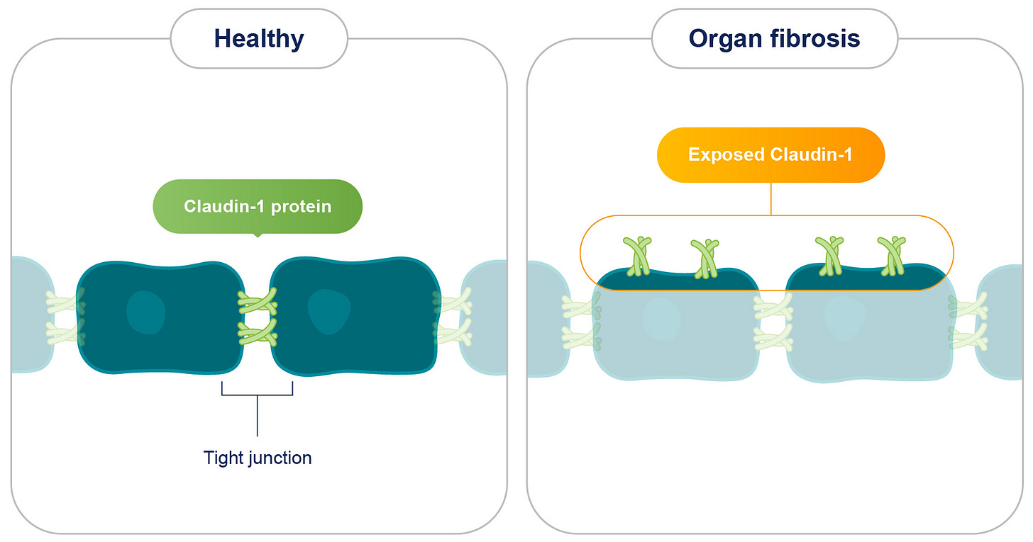 Lixudebart (ALE.F02) for organ fibrosis - Alentis Therapeutics