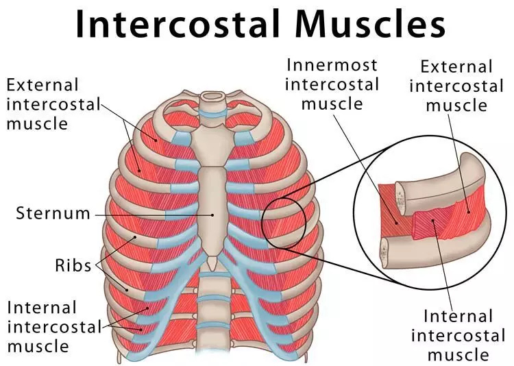 Intercostal Muscle Strain | Orchard Health Clinic ... Intercostal Muscle Strain | Orchard Health Clinic ...