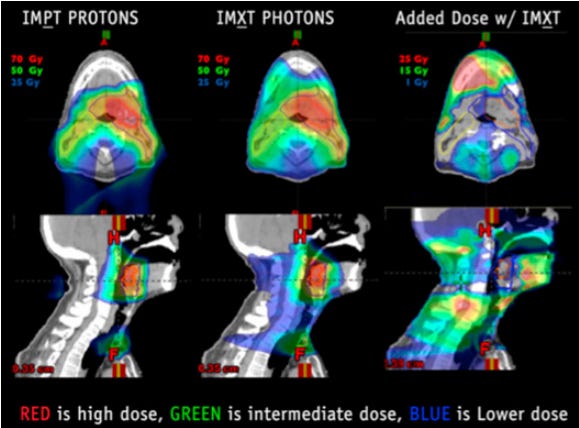 Comparing Intensity-Modulated Proton Therapy With Intensity-Modulated Photon Therapy for Oropharyngeal Cancer: The Journey From Clinical Trial Concept to Activation  SJ Frank