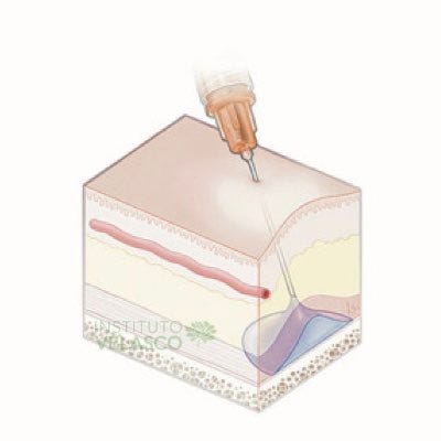 Técnica de aplicação em bolus
