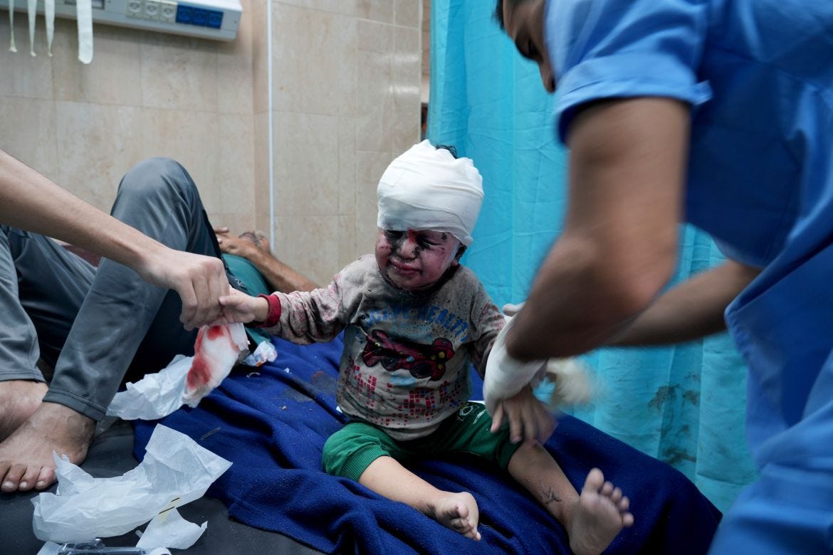 Palestinian child wounded in Israeli bombardment is treated in a hospital in Deir al Balah, south of the Gaza Strip