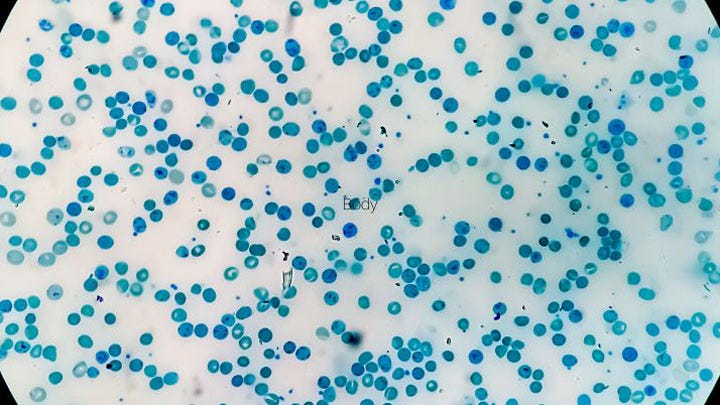 Methylene Blue medical stain