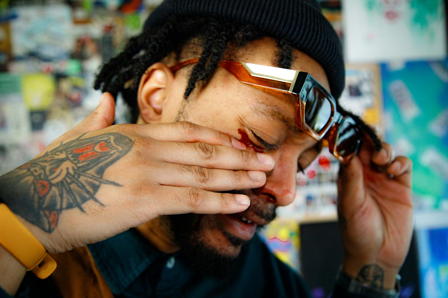 Man with dreadlocks and beanie rubbing his eyes in distress while holding designer glasses, showing signs of emotional burnout or fatigue, with colorful artistic background visible behind him