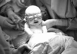 Image result for human fetus birth