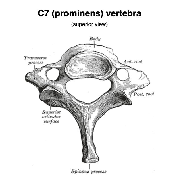 C7 vertebra | Radiology Reference Article | Radiopaedia.org
