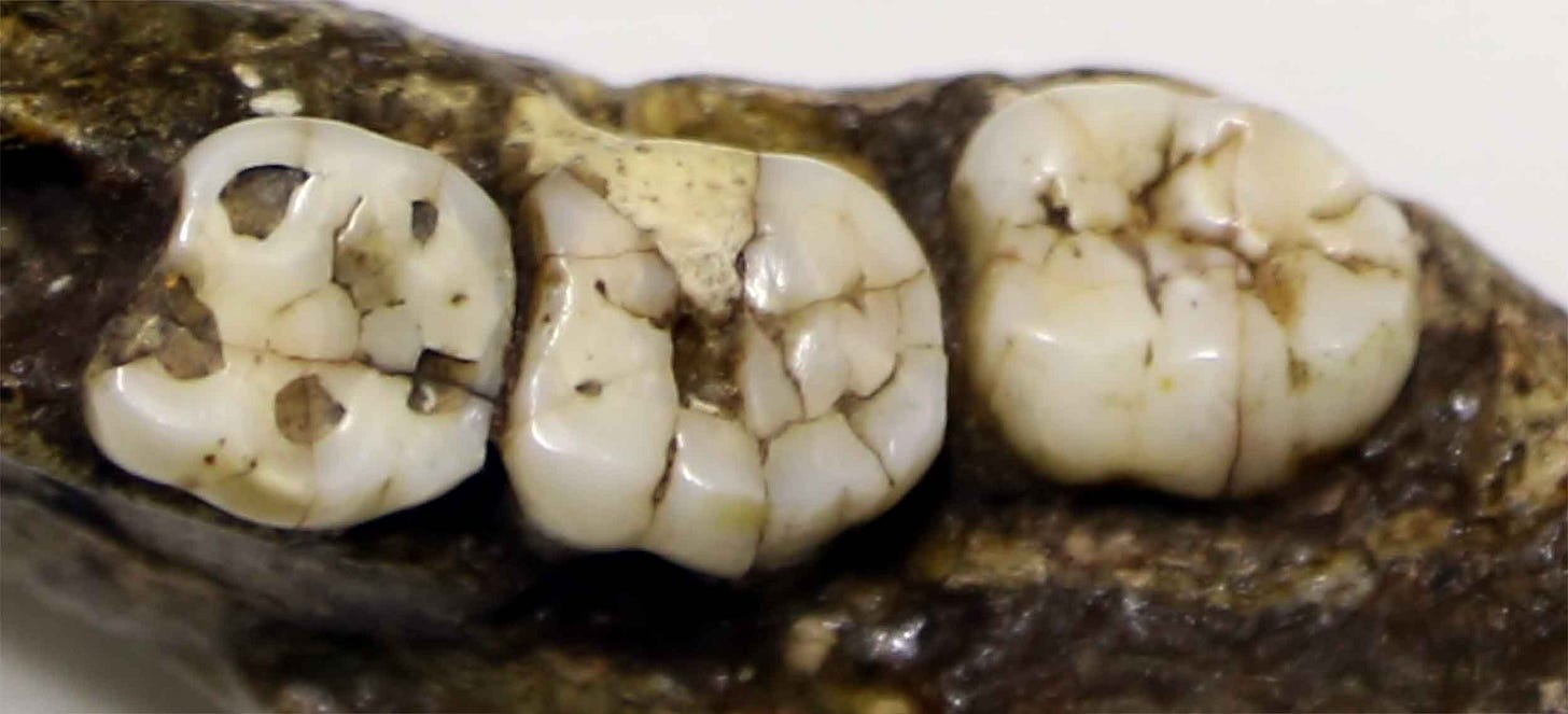 Closeup of three left mandibular molars with cracks and wear