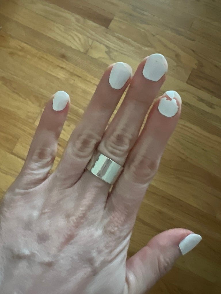 My nails the day after, with cracks and splits