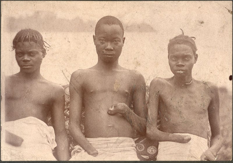 File:Three boys with hands cut off.jpg