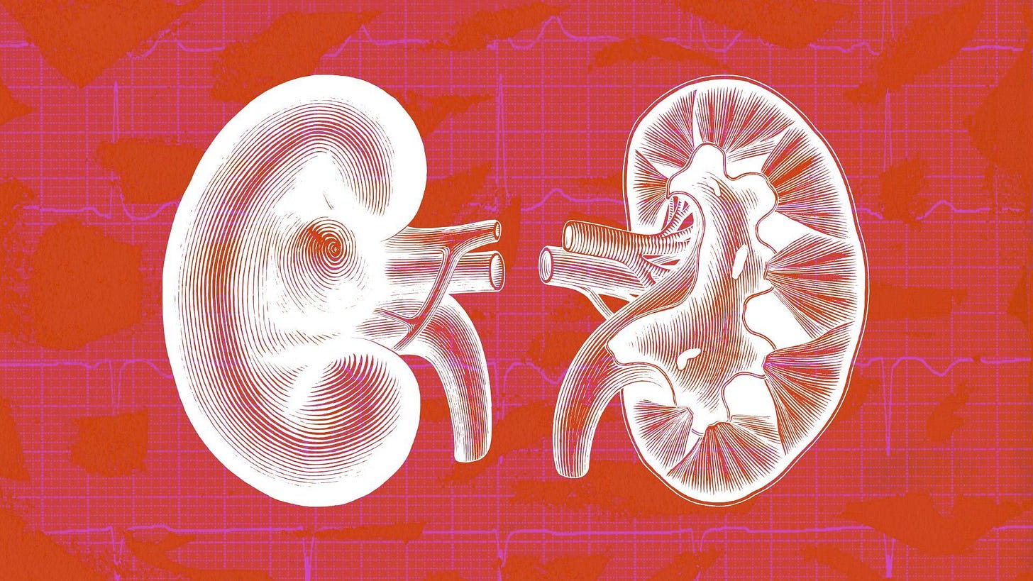 Illustration of a medical diagram of kidneys against an abstract background.