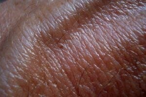 Closeup of human skin. Pixabay