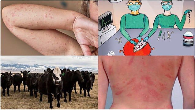 Bomba!  A COVID vakcinák marhahúsfehérjét tartalmaznak, amely halálos allergiát okoz – VIDEÓ