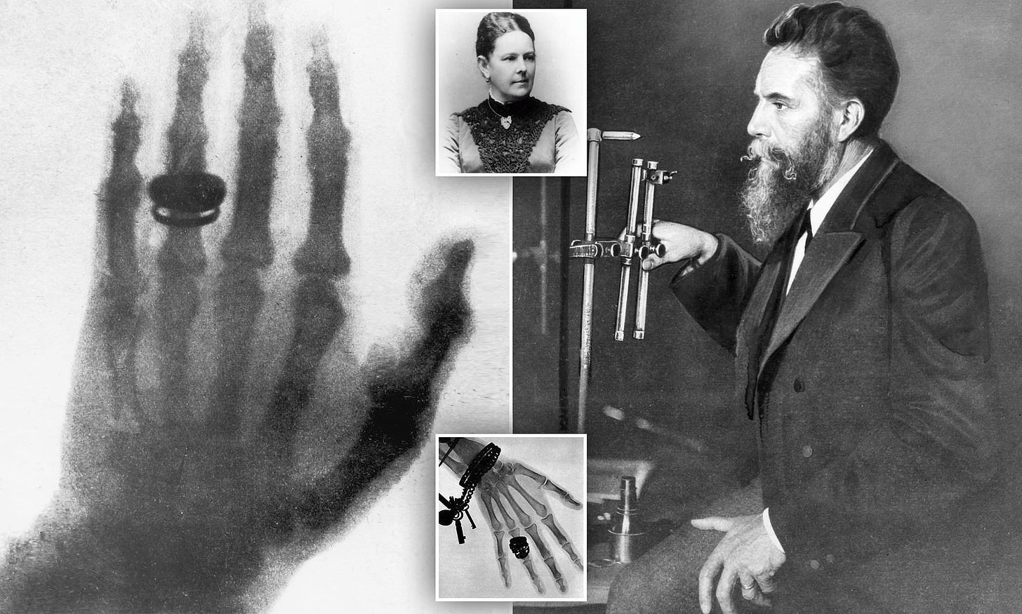 Roentgen's first human X-ray of his wife's hand in 1895 | Daily Mail Online