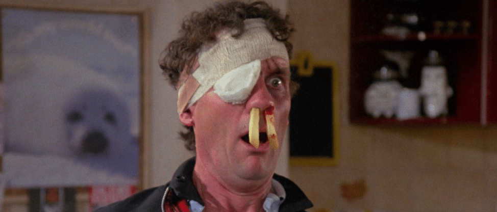 Michael Palin in A Fish Called Wanda, wearing a makeshift eyepatch and with a chip (french fry) protruding from each nostril, a maddened and shocked expression on his face.