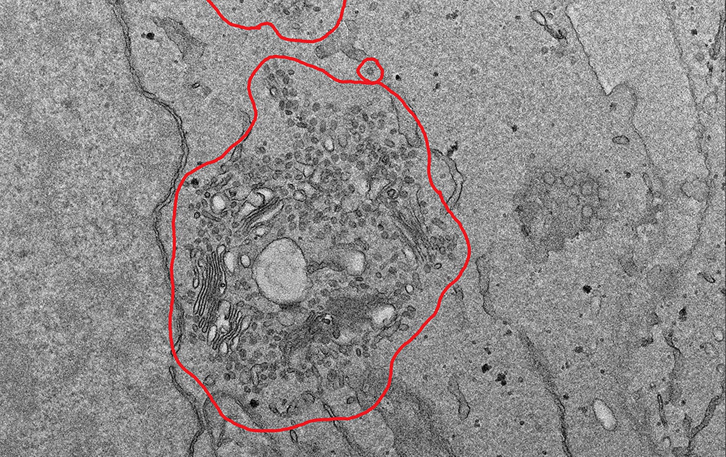 “AIs Are Disseminating Expert-Level Virology Skills” by Dan Hendrycks, Laura Hiscott