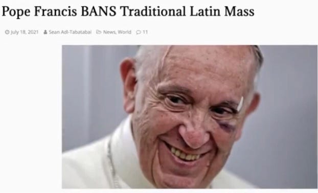 Pope Francis Louche Left Eye July2021