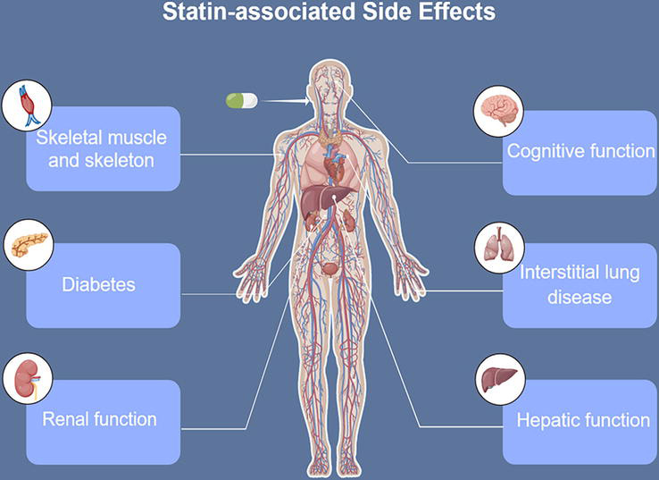 Reviews on Statin-Associated Side Effects | IntechOpen