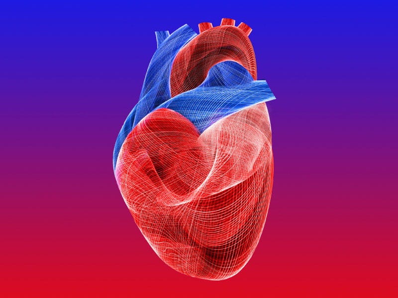Undiagnosed heart disease may be common in people with heart attacks not  caused by clots | American Heart Association