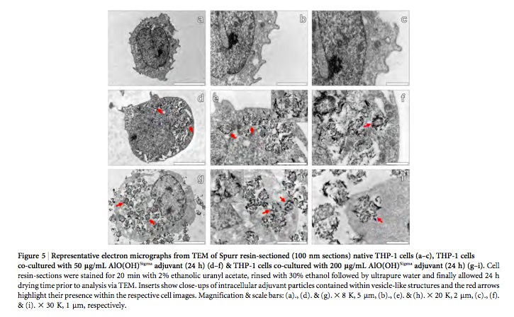 AANs-inside-MF