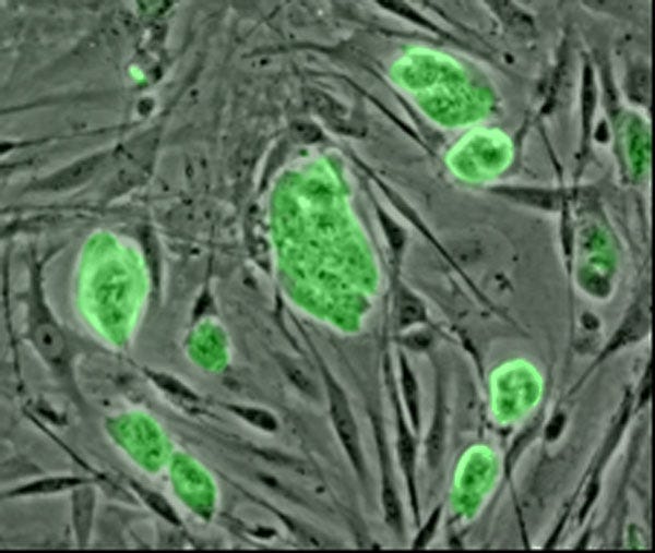 File:Mouse embryonic stem cells.jpg